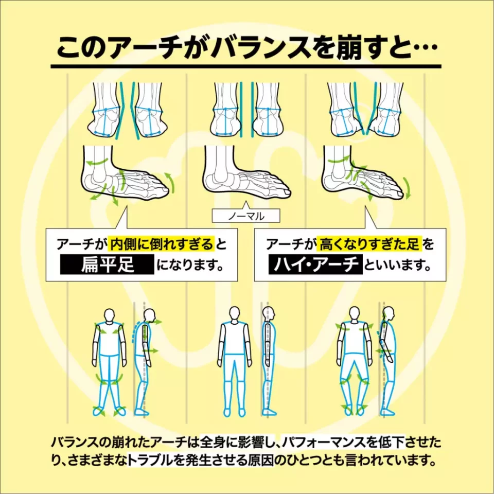 シダスのインソールを使用するメリット2