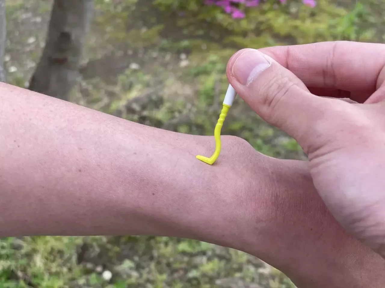 マダニに噛まれた場合に行うべきこと