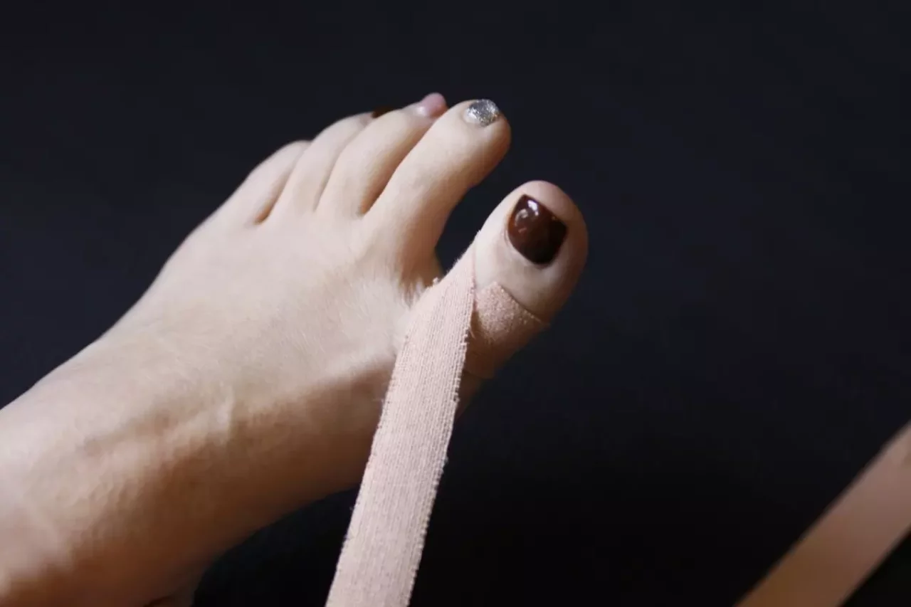 外反母趾に有効なテーピング ステップ1-テーピングの巻き始め