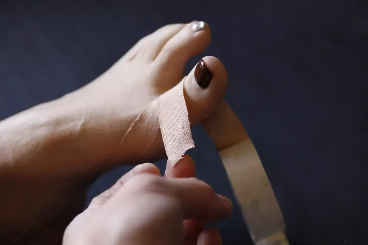 外反母趾に有効なテーピング ステップ4-クロスするように二本目のテーピング