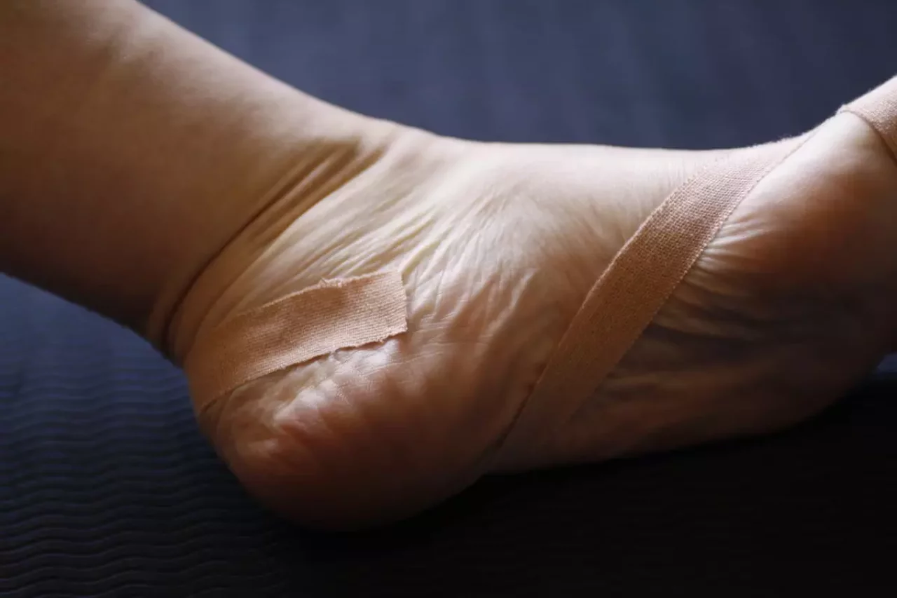 外反母趾に有効なテーピング ステップ3-踵にかけてテーピング